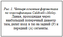 : Puc. 1.       CaldwellMoloy.&#13;&#10;,      ,       ()   () .&#13;&#10;